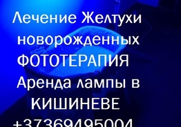 Лампа фототерапия от желтушки. Аренда . У вас на дому лечение желтухи новорожденных. Кишинев. Молдова
